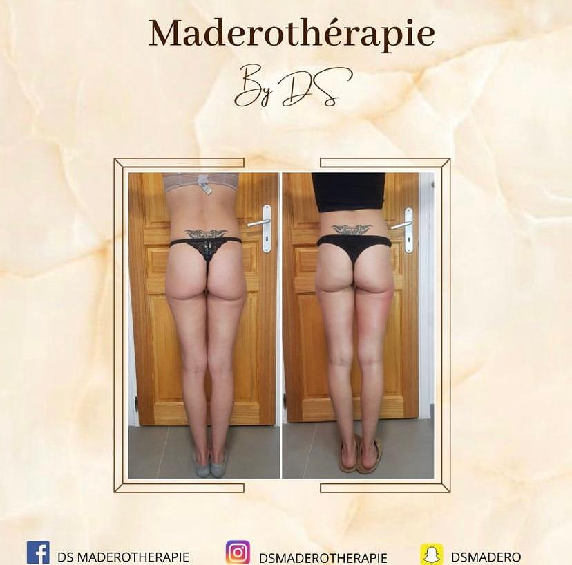 D&S Maderothérapie - Photo 5